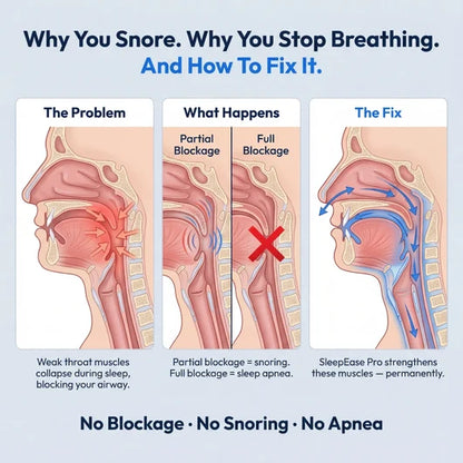 SleepEase Pro™ Anti-Snoring Device
